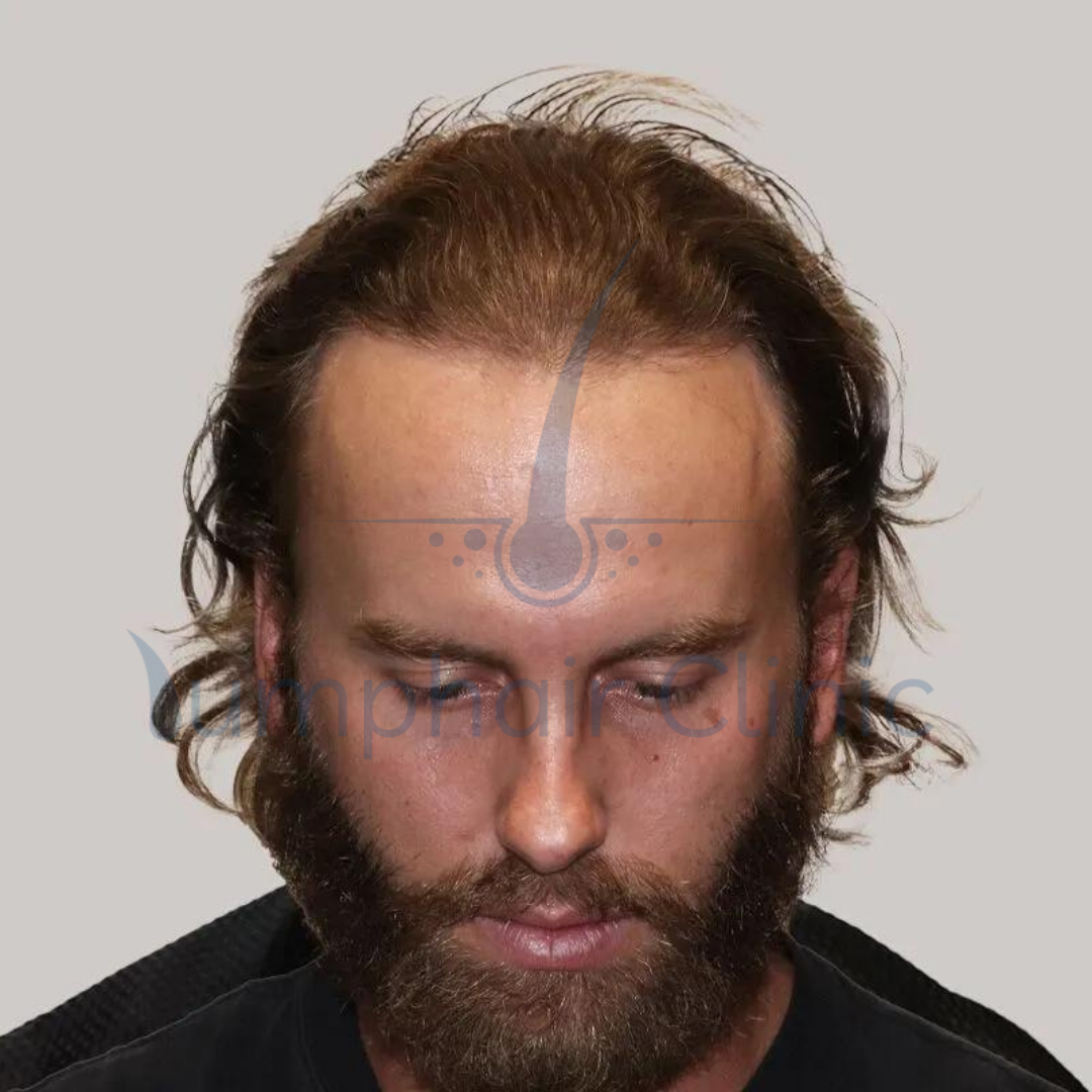 second image