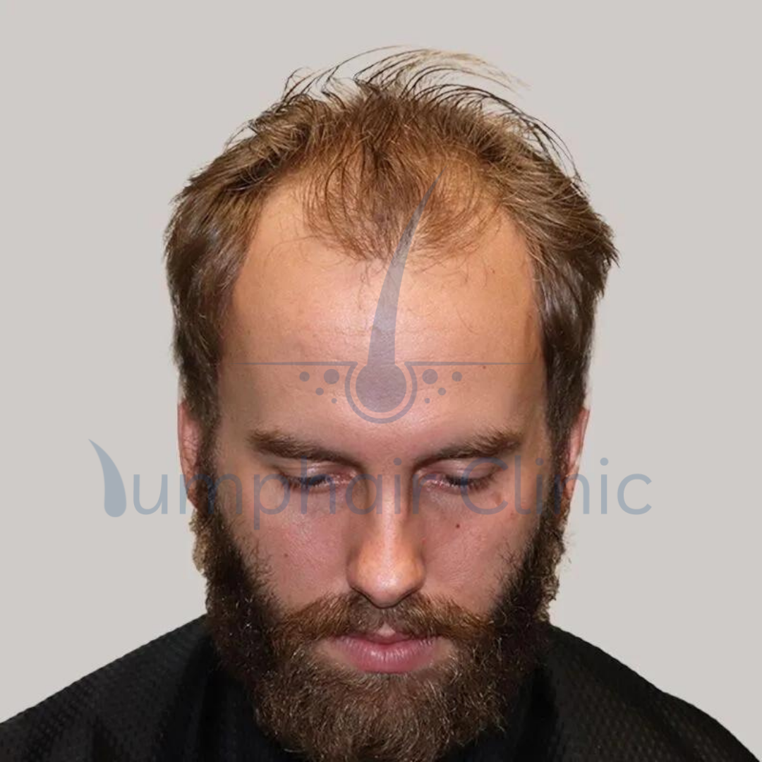 first image
