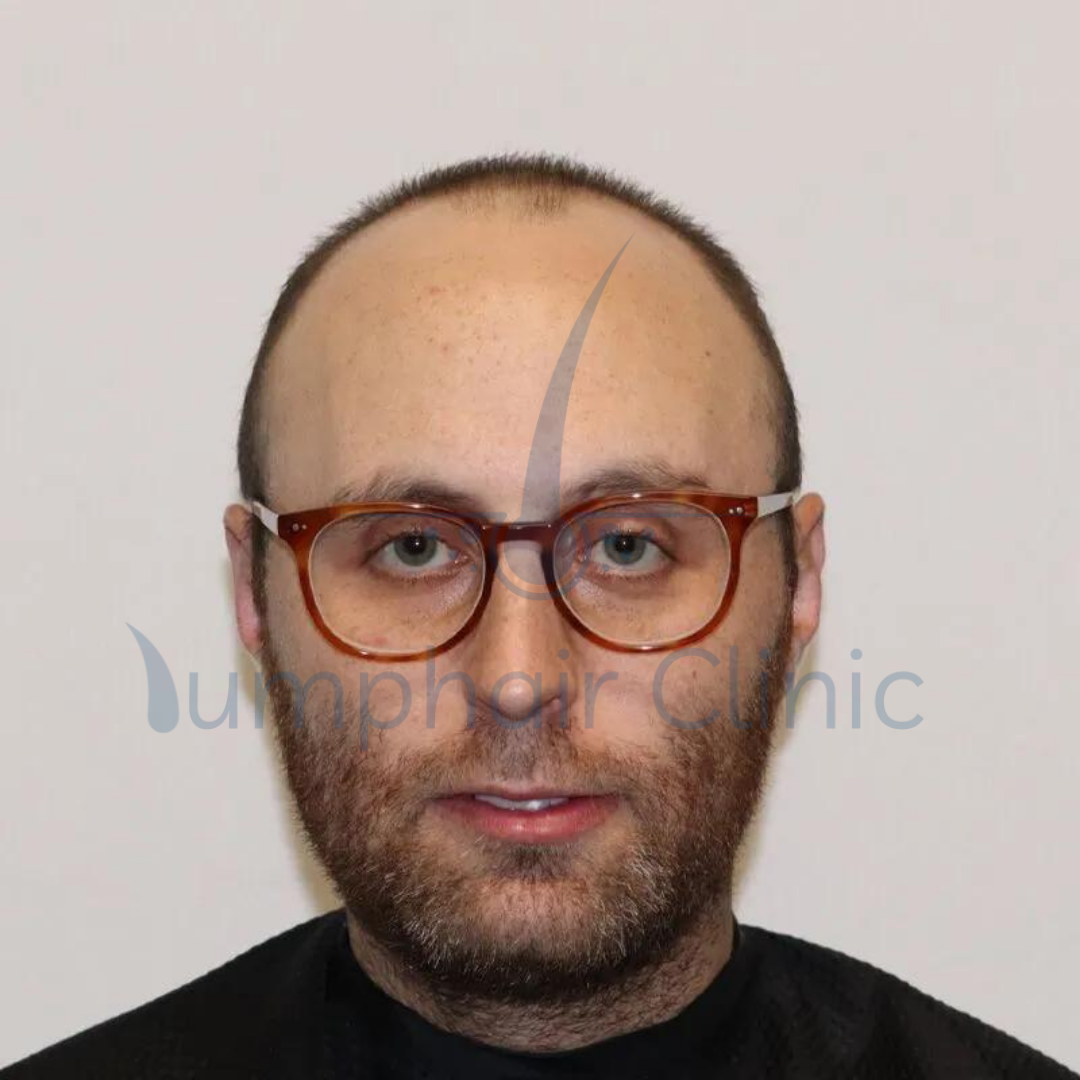 first image