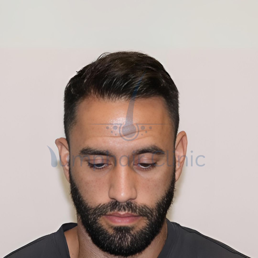 second image
