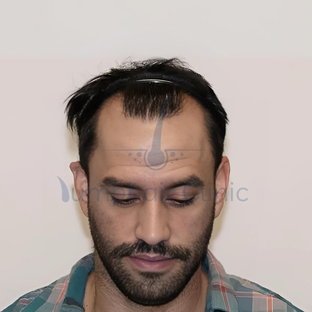 first image